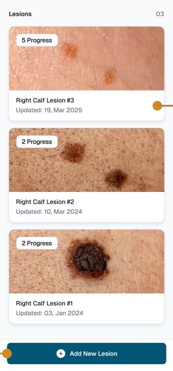 Lesion tracking list in the SkinAware app